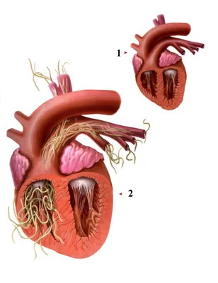 Глисты в сердце человека фото фото