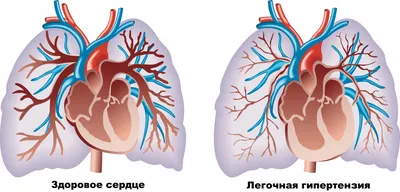 ЧТО ЭТО???😵😵😵–спросите вы. Это дорогие мои глисты в сердце собаки. Наш  Краснодарский край очаг этого заболевания. НИКТО В КРАСНОДАРЕ… | Instagram