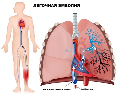 Лямблии: симптомы, диагностика и схема лечения