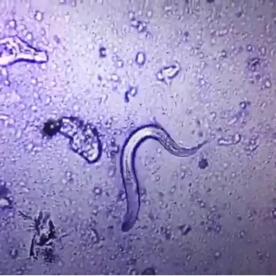 Ложные черви в человеческом кишечнике Иллюстрация штока - иллюстрации  насчитывающей дармоед, люмен: 197136516
