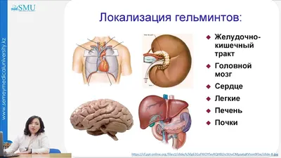 Легочное сердце - причины появления, при каких заболеваниях возникает,  диагностика и способы лечения