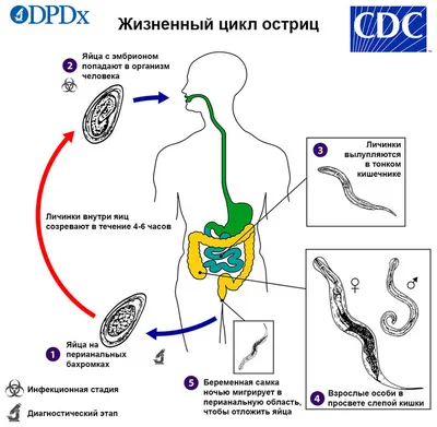 Глисты: фото, симптомы, у человека, у детей, у кошек, анализы