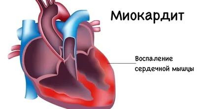 Глисты (гельминты): лечение, признаки и профилактика гельминтоза