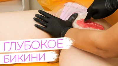 Шугаринг (сахарная эпиляция) зоны глубокого бикини в Москве — 5046  специалистов, 1178 отзывов на Профи
