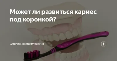 Как проводится лечение корневых каналов зуба?