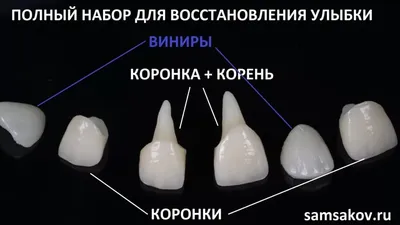 Лазерная стоматология Президент | Moscow
