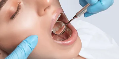 Как сохранить передние молочные зубы