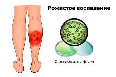 Гнойные заболевания кожи и подкожно-жировой клетчатки - презентация онлайн