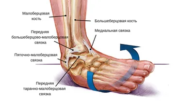 Хроническая нестабильность голеностопного сустава - KinesioPro