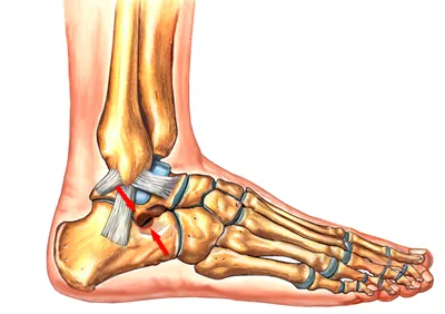 Ушиб голеностопного сустава: распознавание, лечение и восстановление после  травмы лодыжки