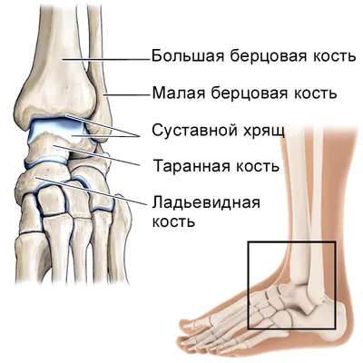 Болит голеностопный сустав - Первая Медицинская Клиника