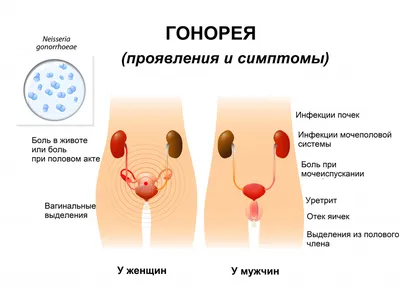 Конъюнктивит: лечение и симптомы, признаки, виды, диагностика