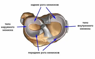 МРТ-диагностика разрывов менисков коленного сустава