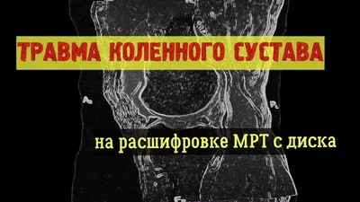 Тейпирование при разрыве мениска коленного сустава | Академия ТТ