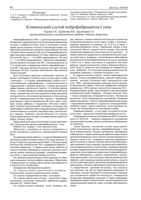 Соска влияет на прикус? Короткую уздечку нужно оперировать? Готическое небо  – это поправимо? Стенограмма прямого эфира со стоматологом-ортодонтом  Елизаветой Целовальник — Благотворительный фонд помощи недоношенным детям  «Право на чудо»