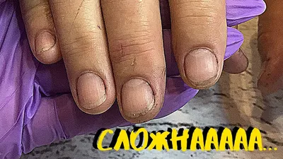 Грязные ногти с грязью временно проживанной в ногтях Стоковое Фото -  изображение насчитывающей ушиб, черный: 145489302