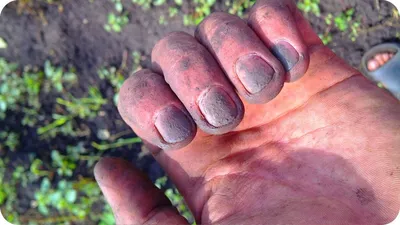 Грязные ногти: описание с фото, домашние хитрости чистки очень грязных  ногтей, правила ухода и поддержание аккуратного вида - Рамблер/новости