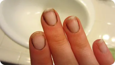 Грязные ногти на белом фоне Понять нездоровое Стоковое Фото - изображение  насчитывающей людск, руки: 160014924