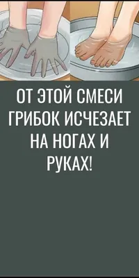 Грибок ногтя на ногах Конец-вверх на белой предпосылке Стоковое Фото -  изображение насчитывающей внимательность, старо: 145499134