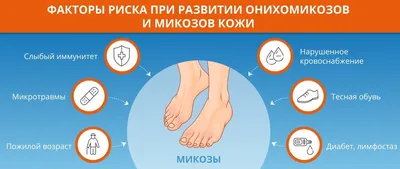 Грибковый блефарит — симптомы - энциклопедия Ochkov.net