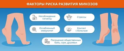 Грибок ногтей на ногах - симптомы, первые признаки, причины, как определить  болезнь