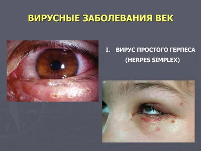 МНТК Микрохирургия глаза им. Федорова - Новости и события