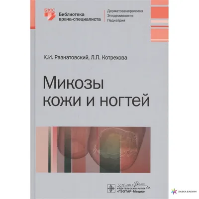 Как вылечить грибок кожи: симптомы болезни и возможное лечение грибка кожи