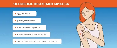 Как обнаружить и лечить микоз: полезная информация