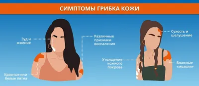 Лечение, диагностика и профилактика микоза в Киеве ≡ Блог MED CITY |  Симптомы микоза