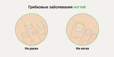Лечение заболевания кожи лица, головы, рук у взрослых и детей в Новосибирске