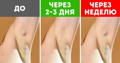Лечение грибка кожи | Асмедия | Санкт-Петербург (СПб)