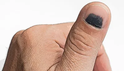 Что означают черные ногти?