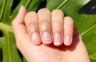 Изменения ногтей - зеркало вашего здоровья | PROsimptom | Дзен