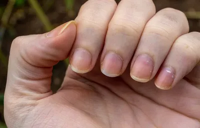 Черные полоски под ногтями (150 фото)
