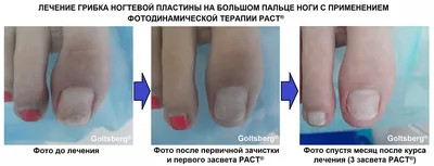 Hespera - ❗️Существует ряд симптомов благодаря которым... | Facebook