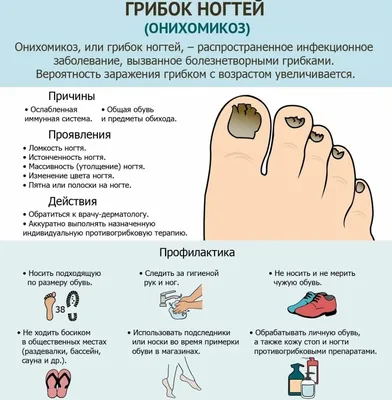 Лечение грибка стопы | Уход от грибка ногтей - Nailyuba