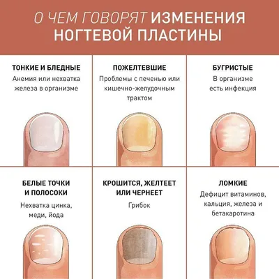 Лечение ногтей на руках | Московская Клиника Подологии
