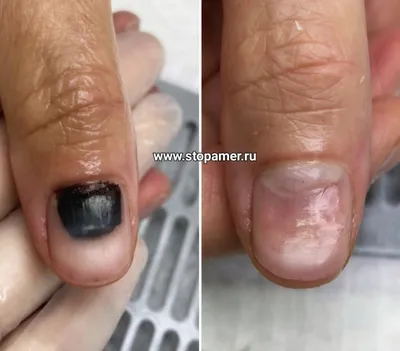 Лак для ногтей EL CORAZON Jelly Active Bio-gel - «Восстановление ногтей  после снятия гель лака био-гелем. » | отзывы
