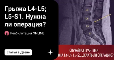 Магнитно-резонансная Томография (МРТ) Пояснично-крестцового Шипами:  Продемонстрировали Грыжа Межпозвоночного Диска В L3-L4 И L4-L5 Фотография,  картинки, изображения и сток-фотография без роялти. Image 20299032