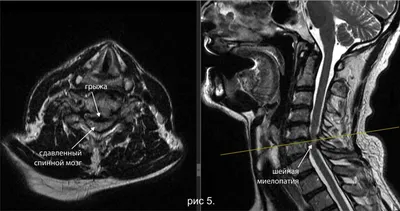 MRI - jaseng.ru