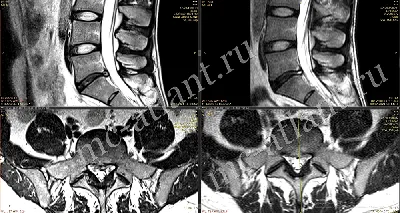 Врач, который не смотрит МРТ позвоночника пациента | Пикабу