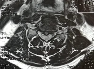 МРТ позвоночника в Ростове-на-Дону цены на магнитно резонансную томографию  позвоночника
