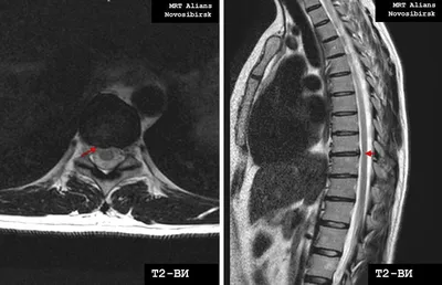 МРТ позвоночника в Ростове-на-Дону цены на магнитно резонансную томографию  позвоночника