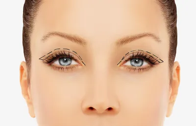 Как ухаживать за кожей вокруг глаз в 25, 35 и 40 лет и что такое  блефаропластика | РБК Стиль