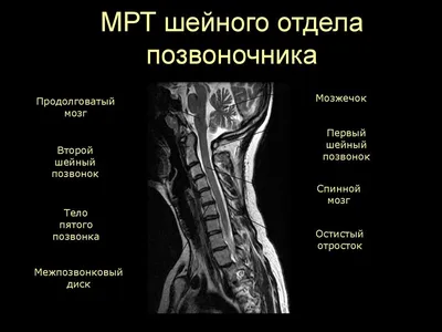 Отзыв пациентки об операции по удалению межпозвонковой грыжи в клинике AXIS  в Москве: \"Я выбрала правильный путь\"