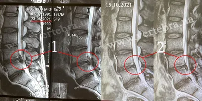 MRI - jaseng.ru