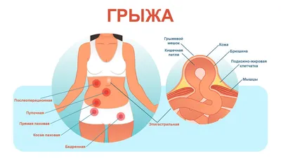 Оперативное вправление грыж паховых у собаки (кобеля), без сохранения  семенников для собак в ветеринарной клинике SQ-lap