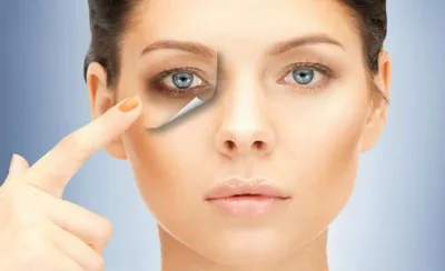Грыжи стекловидного тела глаза: причины, симптомы и лечение