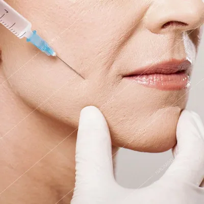 Увеличения губ гиалуроновой кислотой, что нельзя делать после процедуры -  Косметология доктора Корчагиной