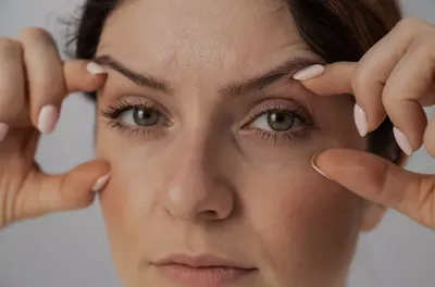 Гусиные лапки вокруг глаз наиболее частая проблема области вокруг глаз .Но  есть решение -инъекции ботулотоксином помогут вам за 1 процедуру… |  Instagram